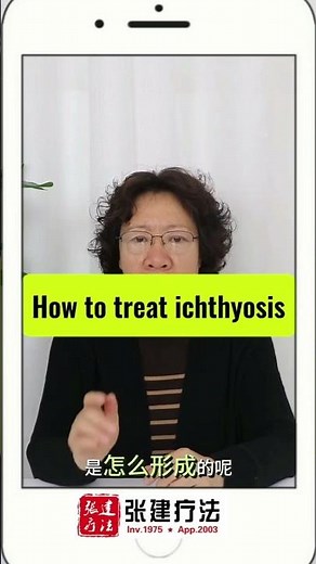How to treat ichthyosis? #ichthyosistreatment #ichthyosis #ichthyosisvulgaris​ #lamellarichthyosis