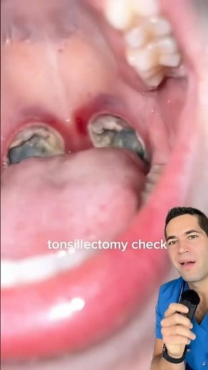 What’s in her mouth?!