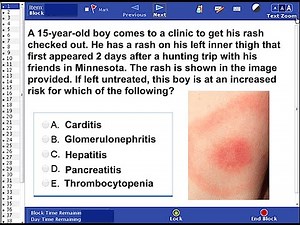 USMLE Step 1: Question 19 (with answer and explanation)