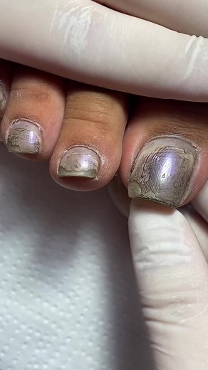 Antes e depois dessa unha 🥰 **Esmaltes usados:** 1. Paraíso - *Impala* 2. Véu - *Colorama* 3. Francesinha com Bianco Puríssimo - *Risqué* 4. Véu novamente - *Colorama* 5. Finalizei com Extra-brilho - *Impala*