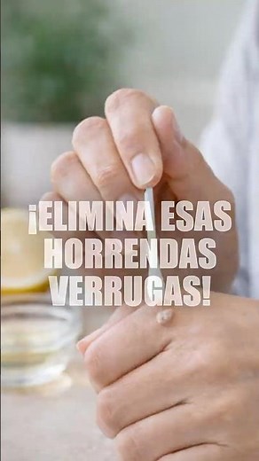 ¡Elimina Esas Horrendas Verrugas!