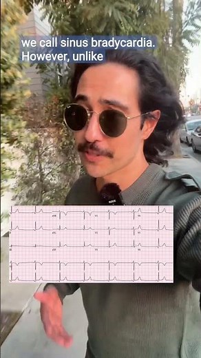 Heart Rate is Too Slow! Doctor Explains #bradycardia #cardiac #doctor