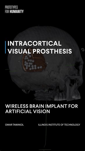 Millions of people around the world live with blindness, and current...