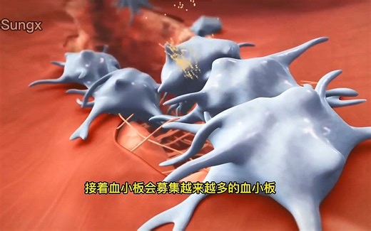 凝血2：【二期止血】凝血级联 Coagulation Cascade