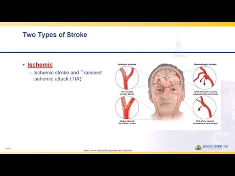 Ischemic Stroke | Lisa Klein