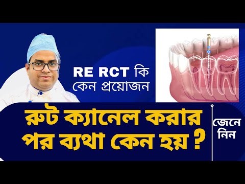 Pain again after root canal? Causes and solutions. Why and when is Re-RCT needed?