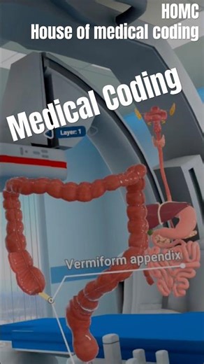 Appendectomy Surgical Procedure | CPT 44950 Learning