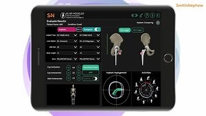 Utilizing Preoperative Planning Tools to Address Spinopelvic Relationship and Hip Dislocation
