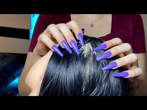 ASMR Dandruff Removal | INSANE Dandruff Scratching, Scalp Check ASMR⚡💤