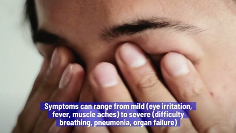 First US Bird Flu Death: What To Know About The H5N1 Outbreak