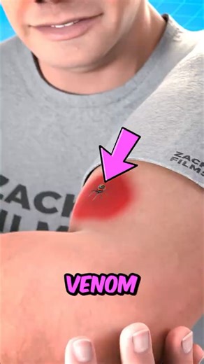 If You Ever Get Bitten by a Venomous Spider, Do THIS Fast! 😱