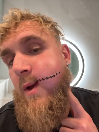 Jake Paul Reveals His New Steel Jaw Innovation