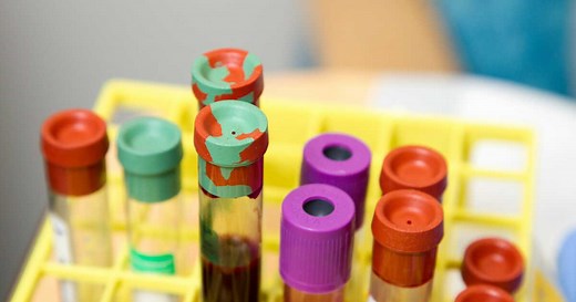 Monocytes élevés ou trop bas : quelles sont les valeurs normales et quel taux est inquiétant ?