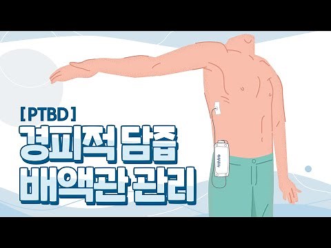 담즙 배액관 관리(PTBD) 방법 알아보세요!