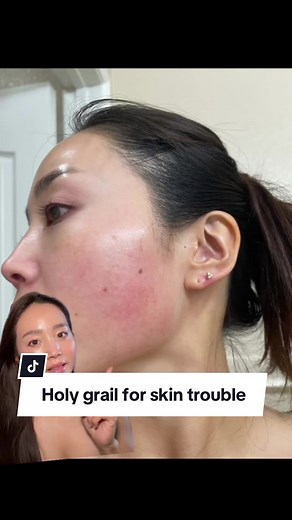 Avene Cicalfate Restorative Protective Cream: 4 Ways to Use It