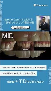 【＋TD】Estelite Asteriaで広がる“患者にやさしい”審美修復 #歯科 #コンポジットレジン修復