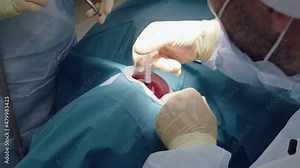 Professional doctors performing dental surgery, treating teeth in the patient's mouth. Surgical operation. Dentistry.