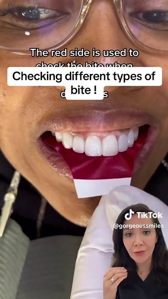 How Dentists Check Your Bite