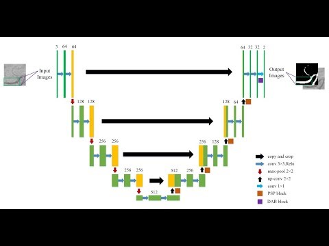 Video abstraction: An improved U-Net model with multiscale fusion for retinal vessel segmentation