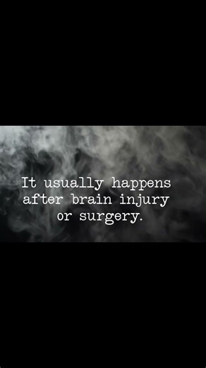 When Your Hand Moves Without You #AlienHandSyndrome #Psychology #Neuroscience #HumanMind #mind