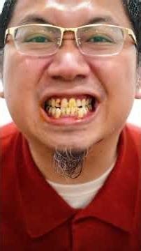 My gums receded due to using the wrong water flosser, but luckily I found the love of my life! #w...