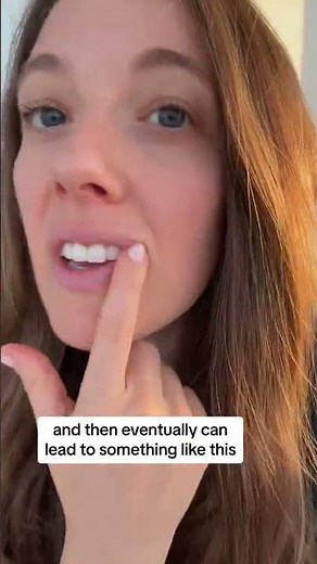 Treating Cracked Mouth Corners