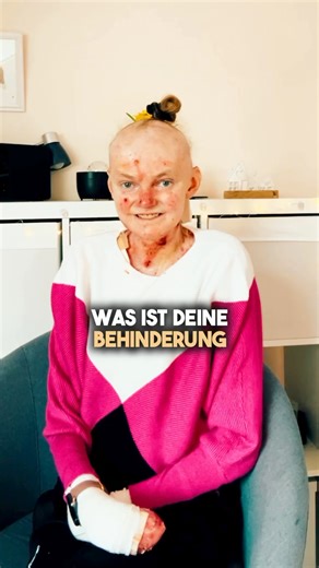 57K views · 1.1K reactions | Clara ist 24 und lebt mit der seltenen Hautkrankheit Epidermolysis bullosa (EB). Die ganze Geschichte liest Du auf Instagram und dem Format „Deine Lieblingsmenschen“.  | Deine Lieblingsmenschen | Facebook