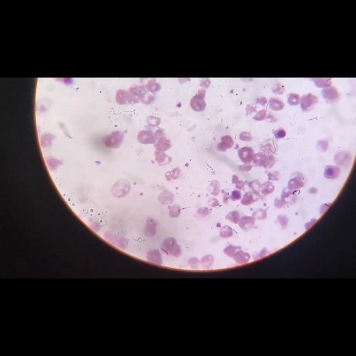 NRBC Identification |How To Identify NRBC|