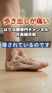 なぜ朝の一歩目だけ痛いのか⁉️歩くと和らぐ足裏の痛みの正体「足底腱膜炎」と放置する危険性‼️ #Shorts #足底腱膜炎 #かかとの痛み #足裏の痛み #鍼灸 #始動時痛 #岐阜市 #鍼灸院