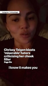 Chrissy Teigen blasted the “miserable” people who criticized the way her cheek filler looked in recent photos. | Page Six