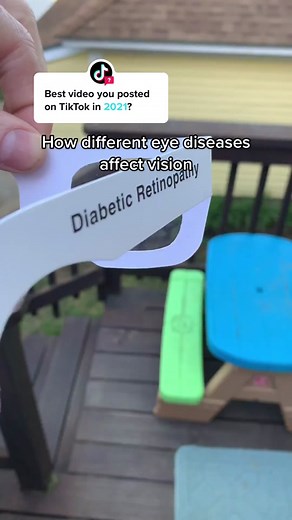 Answer @TikTok Eye Disease Simulation #instructorfortheblind #visionsimulation #eyedisease #simulation