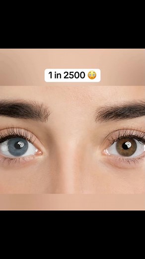 Rarest Human genetics in the world 🌎 | Jumpers Mysteries