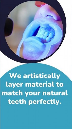 Anterior aesthetic restoration using composite