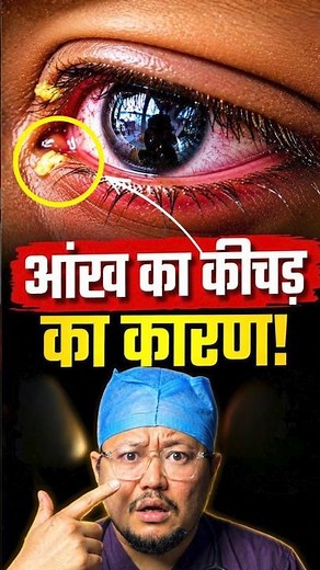 Why Do Some People Get White Eye Discharge