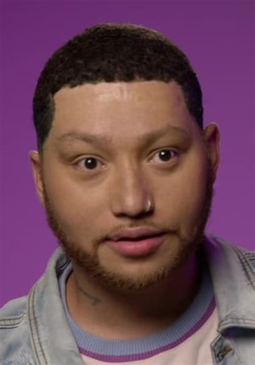 Bad Hair Day S01:E01 - Bye, Alopecia