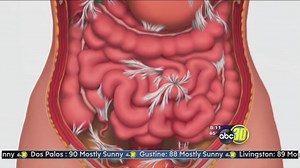 New Adhesion Treatment