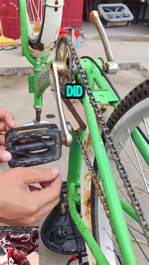 Understanding Tubal Ligation and Family Planning