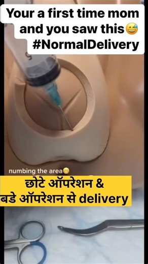 Normal delivery VS C-section #delivery #pregnancy #tips #shorts