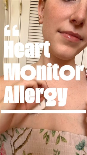 𝐋𝐄𝐗 𝐆𝐈𝐍𝐆𝐄𝐑 | Anyone else have issues with the adhesive? #heartmonitor #med #pots #cardiology | Instagram