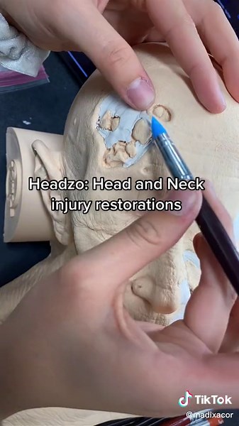 Neck Injury Restoration Techniques Explained