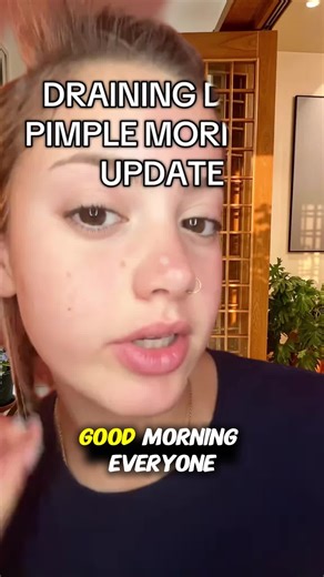 Technique is perfect#dermdoctor #dermatologist #cyst #pimplepopper #learnontiktok