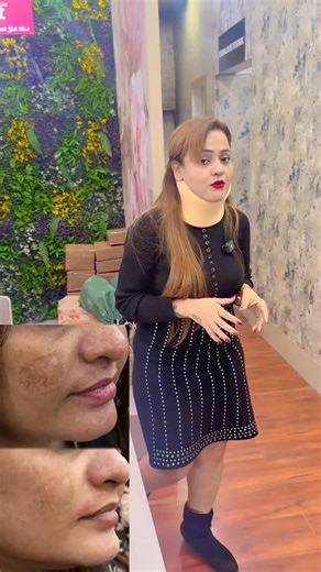 Nisha Lamba on Instagram: "Skin Care ☎️ 9910912742 Add- CSC Market, Sec-18B, Dwarka, New Delhi - 110078 #Facial #Skincare #BeautyTips #GlowUp"