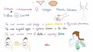 Limited Systemic sclerosis (limited scleroderma or CREST syndrome) vs diffuse systemic sclerosis (diffuse scleroderma) | Comparison | Rheumatology (Musculoskeletal diseases) and Dermatology. | Medicosis Perfectionalis