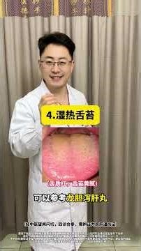 七种常见舌苔，怎么调理呢？ #舌苔 #湿热 #中医 #石家庄市人民医院二月二健康义诊 #石家庄市人民医院健康科普