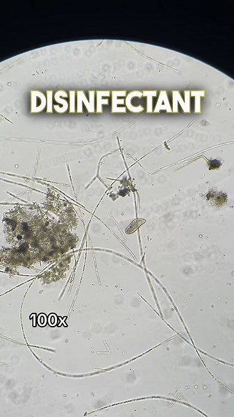 Vinegar vs microbes, what really happens under the microscope?