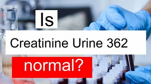 Is Creatinine Urine 362 high, normal or dangerous? What does Creatinine Urine level 362 mean?