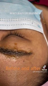 AT RM180 FREE TOUCH UP ITS AN ECONOMICAL WAY OF CHOICE WHATSAPP 0172856388 BOOK FOR YOUR APPOINTMENT NOW | Infinity Beauty Life Solutions | Facebook