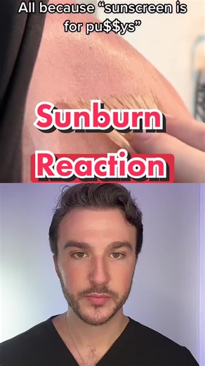 Understanding Sunburn: Risks and Reactions