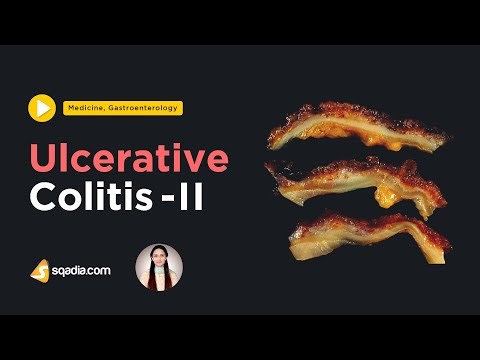 Ulcerative Colitis -II | Gastroenterology Medicine Video | Medical Education