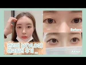 Management Day [VLOG]: Aegyo Filler Review | Pain | Types of Fillers | Duration | Side Effects | ...